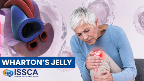 Wharton’s Jelly